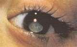 Bird Feeders Human Disease Bird Feeders Human Disease